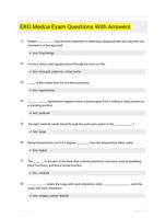 EKG Medca Exam Questions With Answers