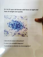 High yield cytology chart for MBBS PATHOLOGY PRACTICALS